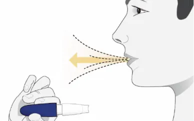 Bilde som viser hender som fjerner delene av Inbrija-inhalatoren merket med en gul pil.